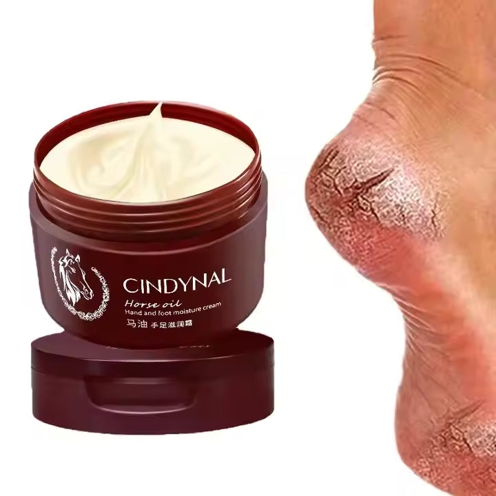 🦶🏼 CREMA REPARADORA PARA TALONES AGRIETADOS 😮